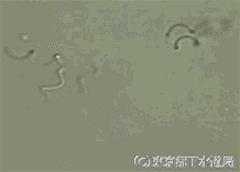 螺旋菌